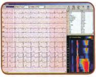 defibrilacije : ugrađena u kutiju PC minimum zahteva: Windows 2000 ili XP CPU 1 GHz HD 40 G - AM 256 M Mikro infuziona pumpa FCG CAD gram za detekciju bolesti arterija i ishemije 3D-VCG za detekciju