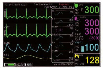 5 Hz do 40 Hz Brzina promene displeja: 25 mm/s EKG veličina (osetljivost): 0,5, 1, 2, 4 mv/cm Mod za detekciju pejsmejkera: indikator u obliku talasa CM: >90 db pri frekvenciji od
