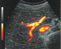 Softver paket za većinu kliničkih primena: - Za abdomen, OB/GYN, kardio-vaskularnu - Inteligentni zoom sistem, realno vreme, zamrznuta zumirana slika Sistem koji se u potpunosti bazira na PC-u i