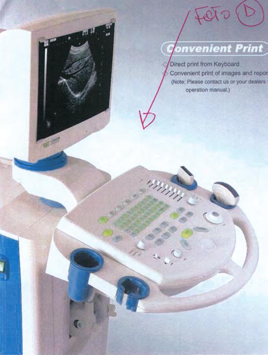 INSPIISAN KVALITETOM B/W digitalni ultrazvučni sistem 33910 Ultra zvuk 8500 Isporučuje se sa dva konektora za sonde, postoljem, praktičnom tastaturom, memorijskom karticom i 14 SVGA monitorom, bez