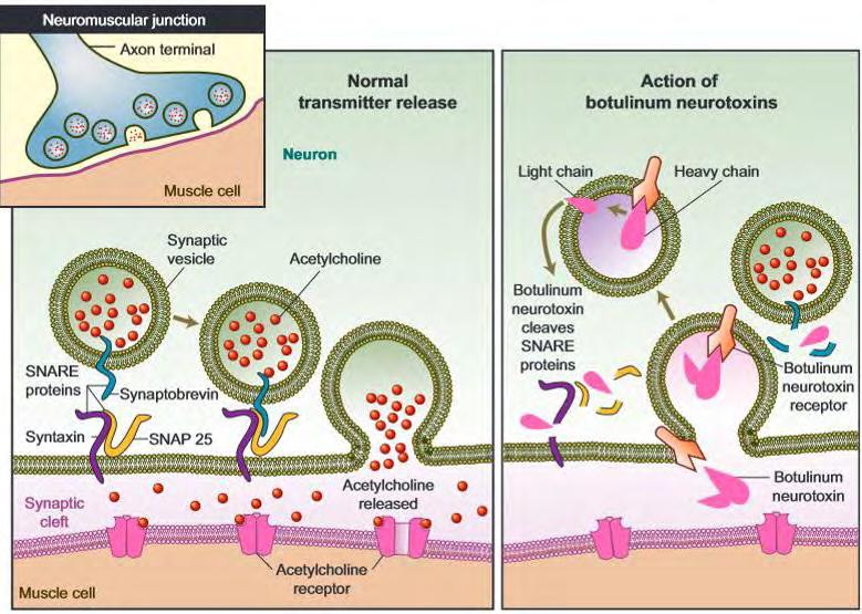 ενδοσπόρια Clostridium botulinum,για αυτό και υπάρχει σαφής προειδοποίηση σε γονείς και φροντιστές παιδιών να μην ταΐζουν με μέλι βρέφη κάτω του έτους.