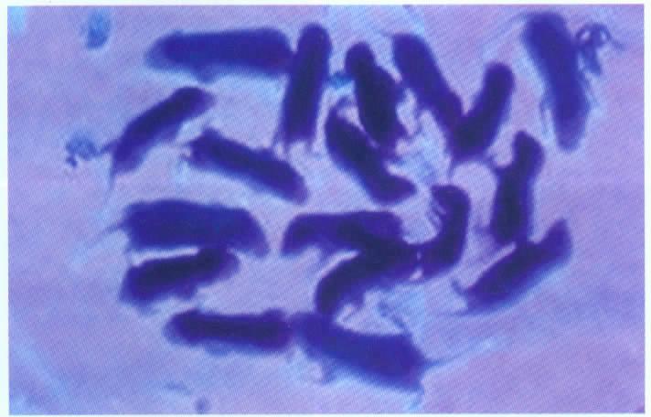 Fig. 3 3 F1 The photo of F1 offspring under ultraviolet light 2.