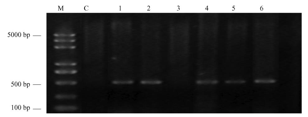 2 DNA 155 Fig. 4 4 F1 PCR The results of genomic DNA PCR test M. DL2000 Plus DNA C. 1 2 4 5 6 PCR 3 PCR M DL2000 Plus DNA marker C Control group 1 2 4 5 6 Positive PCR product 3 Negative PCR product.