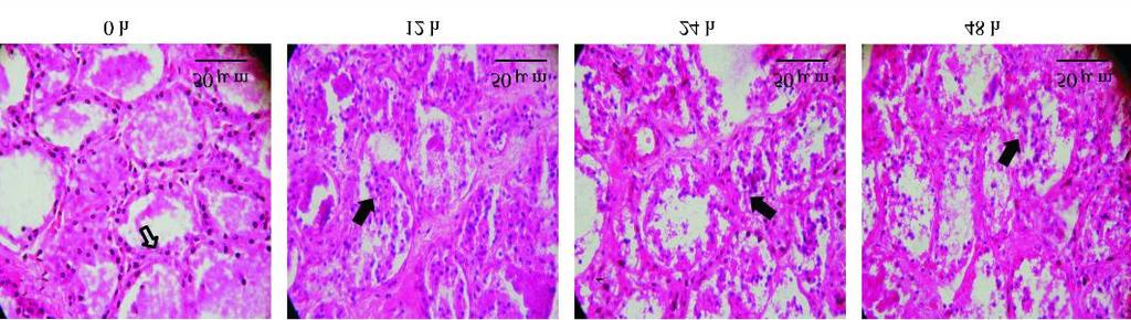 2, : 1 HSP 70 121 ( 3) TGF2 1 48 h, ( 42A),, ( 42B ) TGF2 1 Caspase23, DNA, 3 TGF2 1 F ig13 Effec t o f TGF2 1 o n m o rp ho