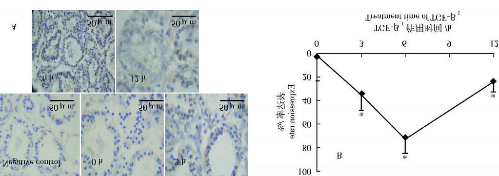 Hc: Heterochromatin TGF2 1 3 h HSP 70, 6 h, 12 h, ( 52A B ) TGF2 1 3 6 h HSP 70 3 5 TGF2 1 HSP 70 (A) (B ) F ig15 Effe c t o