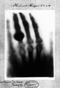 Ακτίνες Χ (X-Rays) Πολύ μικρό μήκος κύματος, ψηλή