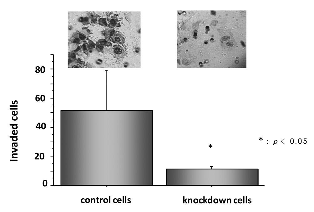 72 SPP UGT A ANXA 4.2.2.2.8.8.8.6.6.6.4.4.4.2.2.2 control sirna control sirna control sirna p.5 Survival rate 8 6 4 2 p.5 control cells knockdown cells BCL 2 L CFLAR CCND.2.2.2.8.6.4.2.8.6.4.2 control sirna control sirna control sirna p.5.8.6.4.2 Invasion assay PCR SPP UGT A ANXA BCL L CFLAR CCND survival rate invasion assay TUNEL assay CPT HNFbeta IGFBP GLUT G Pase HNFbeta HNF beta Tsuchiya HNF beta HNFbeta