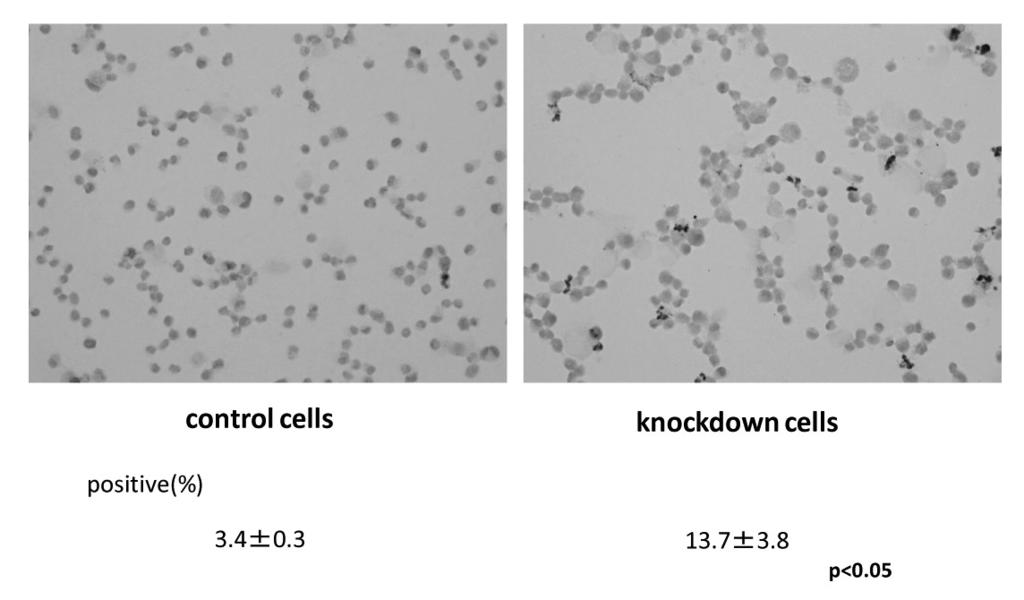 HNFbeta 73 TUNEL assay sirna HNFbeta HNFbeta HNFbeta sirna HNFbeta HNFbeta SPP CFLAR BCL LCCNDUGT A ANXA HNF beta HNFbeta Cell Viability 2 8 6 4 2 2 5 2 3 4 5M sirna control CPT MTS HNFbeta