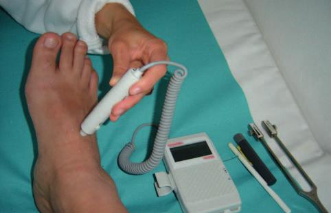 Autonómna neuropatia je špecifickým druhom polyneuropatie. Postihnuté sú nervové vlákna vnútorných orgánov srdca, tráviaceho traktu, močovo-pohlavného systému alebo endokrinného systému.