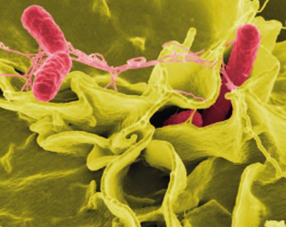 absces pečene, mozgu. Závažné sú infekcie cievneho riečišťa. Salmonely môžu spustiť imunopatologické procesy s klinickými prejavmi erythema nodosum a reaktívnej artritídy.
