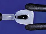 Pre polimerizacije svetlom, moraju se postaviti providne matrice između zuba da ne bi došlo do lepljenja zuba.