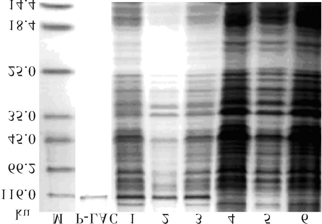 2 : 177 ( 321 2 3), 2. 1494 DNA PCR, 117. 6 ku, 3 kb DNA ( 1), (3 078 bp), pmd182 T S al X ho,, 3 kb DNA ( 2), ( 322) ( 321) 2, pmd182t M. DNA DNA marker ; 1. lac4 PCR PCR product of lac4. 1 PCR Fig.