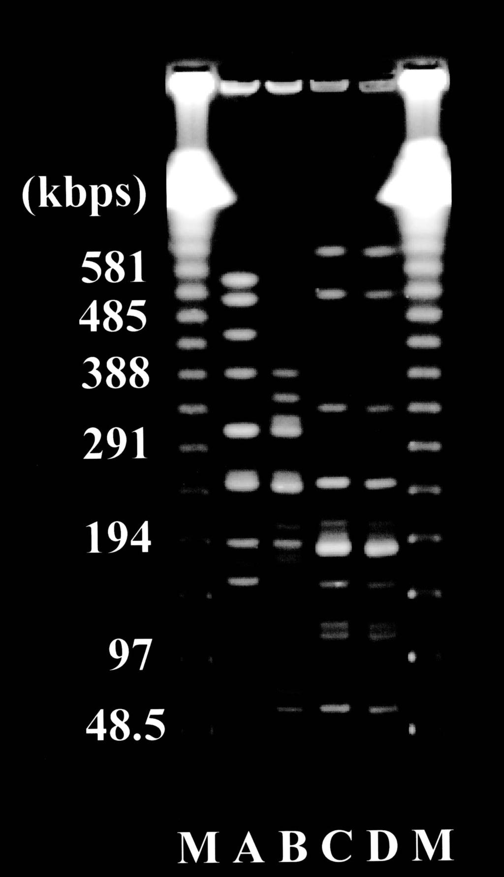 ESBL Antimicrobial agent Table 1MICs of antimicrobials for Escherichia coli isolates from patient with pyelonephritis MICµgmLfor Antimicrobial MICµgmLfor Rec 1847 Rec 2132 agent Rec 1847 Rec 2132