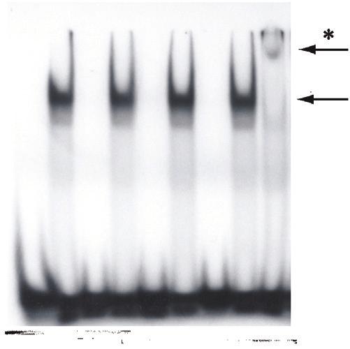 1 2 3 4 5 6 7 8 9 DLX3 Consensus P32 p21 P32 1- Consensus probe 2- Consensus probe + DLX3rp 3- Consensus probe + DLX3rp + competive sequence 4- Consensus probe + DLX3rp + unspecific competive