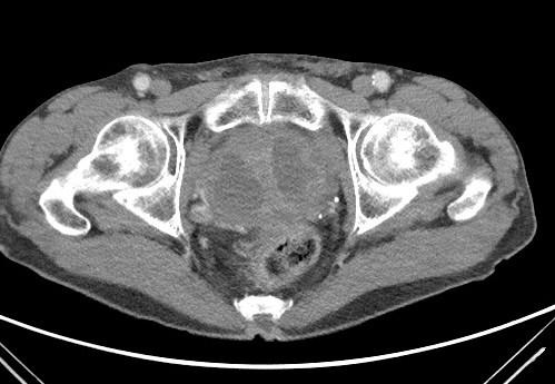 4mls ofcontrast at a rate