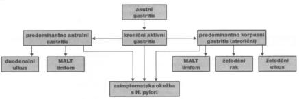 1) razporeditev bakterije po celem želodcu (pangastritis) kronični aktivni gastritis lahko vodi v MALT; 2) razporeditev bakterije pretežno po antrumu (antralni gastritis) lahko vodi v duodenalno