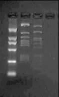 3 :HPV 23 HPV HPV DNA 23 HPV 0 GOPS-PLL HPV RD- PCR 5 HPV M 2 M M 2 000 00 000 00 000 00 A B HPV6, 8 DNA (A) HPV6,8 DNA Sau3A ; (B) HPV6 DNA Cy3- ; (C) HPV8 DNA Cy3- Fig Agarose gel electrophoresis
