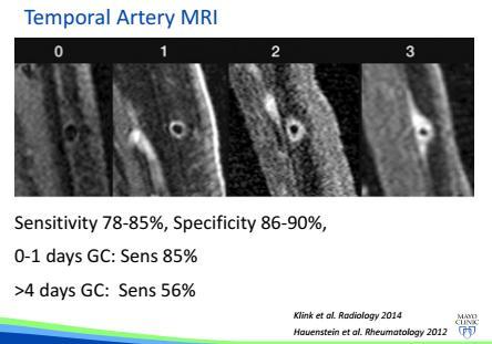 MRI