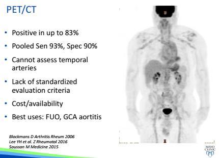 PET / CT Injection of the substance in the feet: