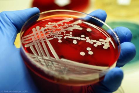 Διερεύνηση στελέχους Staphylococcus aureus με αντοχή στην λινκομυκίνη 14 λυσοενζύμων με την μέθοδο Schleifer & Kloos (5), η αντοχή τους στην βακιτρακίνη και η ευαισθησία τους στην φουραζολιδόνη (6).