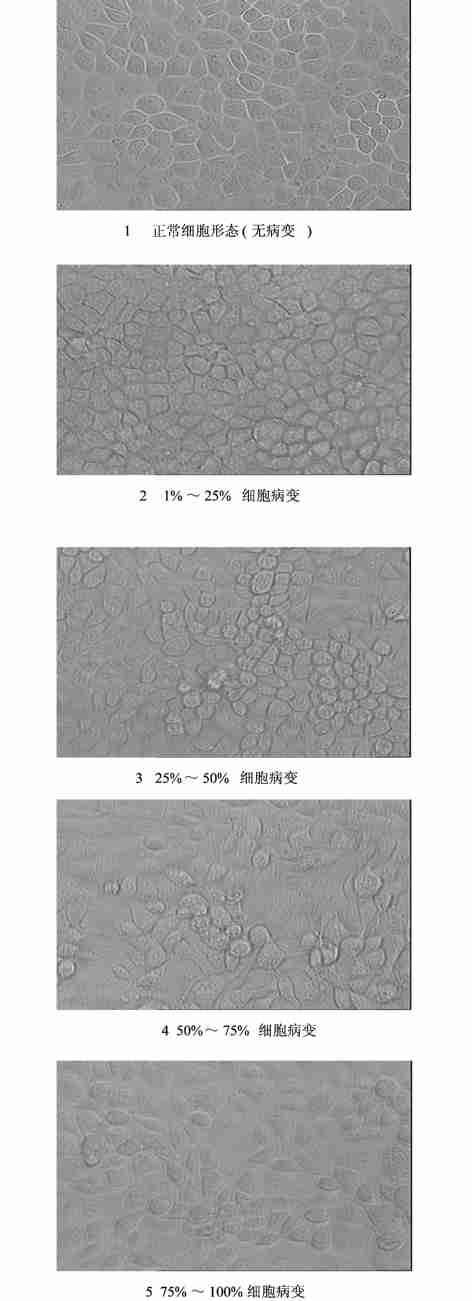 A(H1N1) 395 21313 MDCK CPE, MTT A= 570 nm, 1 MDCK, ;2 MDCK,MDCK ;3 MDCK,,3 21314 A ( H1N1) 1 : 2,20gΠml 10gΠml 115, 2 :10gΠml, ;3 :20 10 750 300gΠml 115,,4