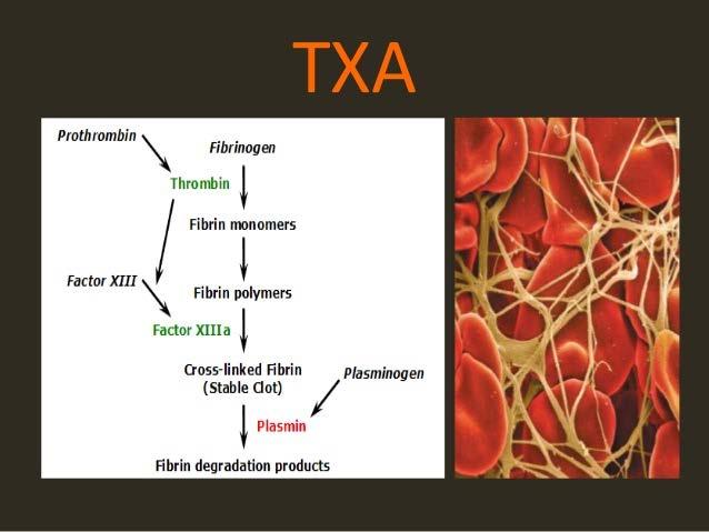 Διαταραχές αιμόστασης-αντιμετώπιση Τρανεξαμικό οξύ (Tranexamic acid, TXA) Το ΤΧΑ θα πρέπει να χορηγείται σε χρονικό διάστημα <3 ωρών