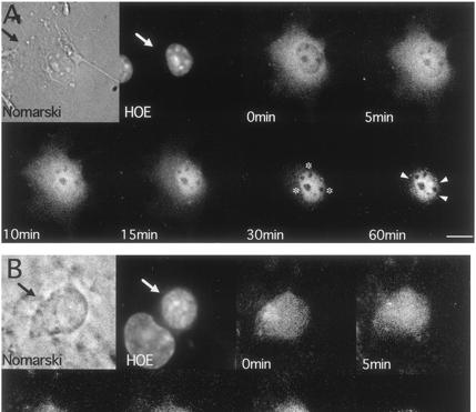 Mineralokortikoidni receptor se po vezavi liganda premakne iz citoplazme v