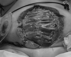 recognition and management of complications once they occur.