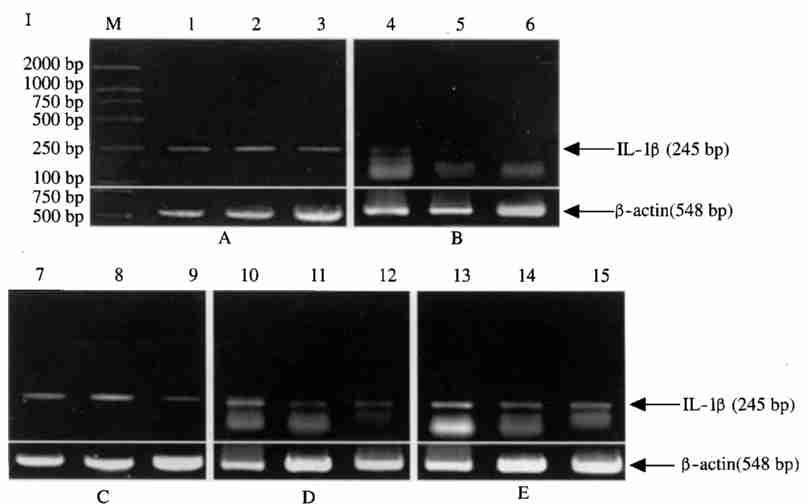 1 : IL21 IFN2 51 2 IFN2 IL21 I. hrifn2 IL21 mrna.
