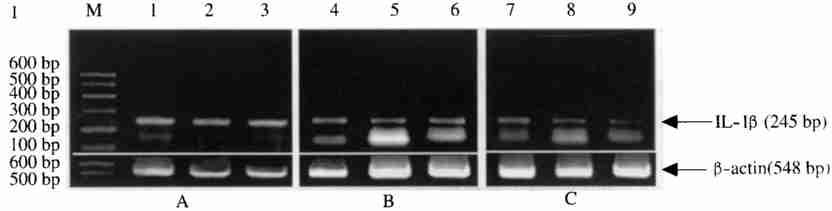 1 : IL21 IFN2 53 3 IFN2 IL21 I. hrifn2 IL21 mrna.
