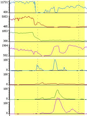 Patterns of bolus