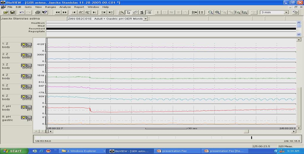 relevant reflux?