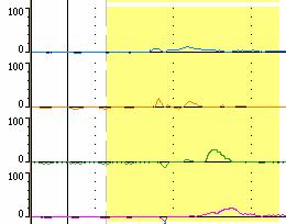 bolus clearance