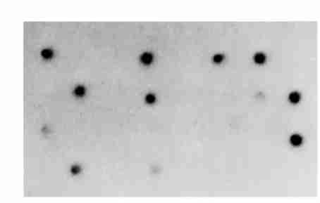 3, p ro tein 1, 56%,, 55, 13 (P rodom ), DNA,, 23. 7% R ing2box p ro tein 1 ; F ig. 3 Reverse do t2blo tting hybridization The do ts are cdna fragm ents of RA FL S fixed on N C m em brane.