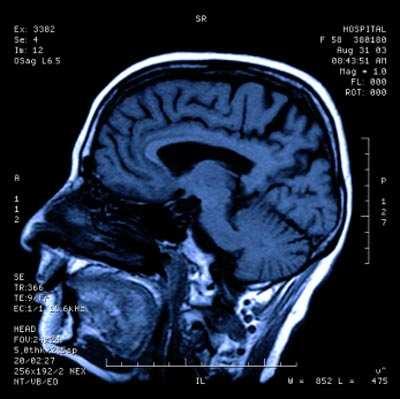 Obrázok 11 demonštruje prístroj na zobrazovanie magnetickou rezonanciou a obr. 12 je obraz mozgu človeka získaný takýmto zariadením.
