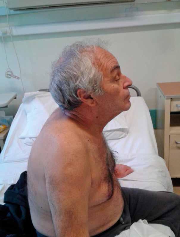 ν ε Νευρολογικές Εικόνες