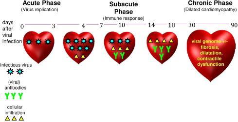 Μυοκαρδίτιδα Η αρχική λοίμωξη (ιογενής) εντοπίζεται συνήθως στο αναπνευστικό ή το γαστρεντερικό σύστημα, Μπορεί να προκαλέσει συστηματική ιαιμία (εντός 0 έως 3 ημερών), φλεγμονώδη απάντηση με