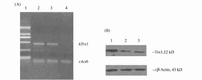 468 25 Fig.1 Transient overexpression of Trx1 gene in HBZY21 cells HBZY21 cells were transfected with PIRESpuro32sense Trx1, PIRESpuro32antisense Trx1 and control.