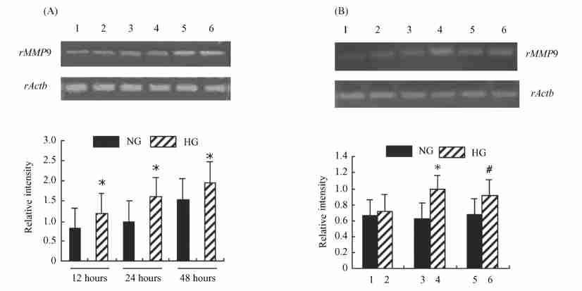 1 : Marker ; 2 : PIRESpuro32sense Trx1 plasmid group ; 3 : PIRESpuro32antisense Trx1 plasmid group ; 4 : Control group. (B) Western blotting.
