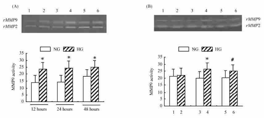 5 : Trx1 HBZY21 MMP9 469 ( P < 0101) ;,HG MMP9 NG 12210 1412 %, ( P < 0101).,1 3 5 MMP29, ( P > 0105) (Fig13B)., Trx1 MMP9. Fig.