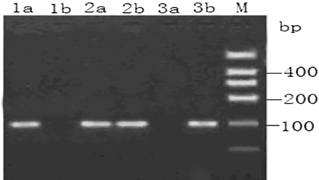 2. rs2066853 141 Na2EDTA - 2A 2B 3 DNA TNE -20 DNA 5μL DNA 195μL 40 260nm 280nm OD OD260/OD280 1.8~2.0 DNA 1.2.2 Tag 2a 2b AG 3a 3b GG 10 Buffer Mg 2+ dntps DNA Maker 1 AhR rs2066853 AS-PCR Gold view 1.
