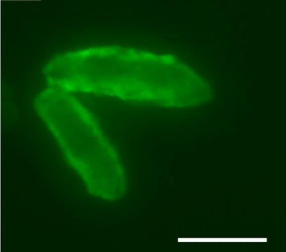 Biochem Biophys Res Commun. 2003, Wright et al. 2004. FASEB.