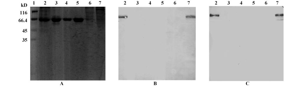 544 203 29 2 2. 2 ELISA Tab. The characteristics of two VZV antibodies 2 5F6C8 VZV-gp 8H5D VZV-gp 200 μl / 37 2 00 μl / 37 5 00 μl / 37 45 5 TMB 00 μl / 37 5 2 mol /L H 2 SO 4 450 /630 3 Tab.