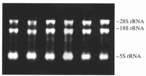 4 RNA 1 6 6 RNA Fig14 Total RNA from the pituitary of grouper Lane 1 to Lane 6 showed that the content of total RNA added into every well was equivalent.