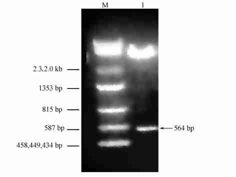 658 21 p GEX2TK2 TNN I2, (Fig13) ( Fig11), ERR 1 ERR 1 TNN I2 cdna ERR 1 GST2TNNI2 Fig 3 Transactivation functional analysis of ERR 1 in HeLa cells 1 :Reporter (p GL32(SFRE) 3