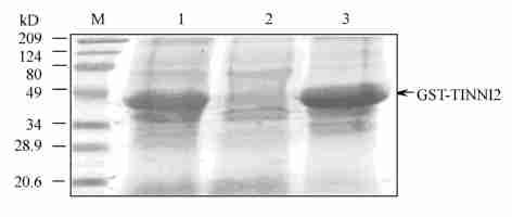 endonuclease digestion M: Marker ; 1 :Recombinant plasmid digested by BamH I and EcoR I The insert was about 564 bp 2 2 GST2 TNN I2 p GEX2TK2 TNN I2 38 kd (Fig12) GST 2 5 GST Fig 4 2GST2TNNI2 35