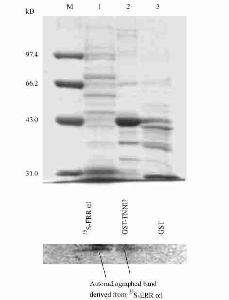 fraction ; 3 : Insoluble fraction 2 3 psg52err 1 ERR 1 cdna T7 2 4 psg52 ERR 1 psg52err 1 ERR 1 p GL32( SFRE) 3 2SV40 promoter2 Luciferase HeLa Fig 4 In vitro interaction of TNNI2 with ERR 1