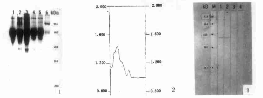 1999; 17 (6) 325329 Ch inese Journal of Parasito logy and Parasitic D iseases 327 1 SDS-PAGE 1HeLa 2C1 3C3 4C5 5C7 62SDS-PAGE (C3) 3W estern blotting M : 1, 23, 4HeLa : 14 F ig.