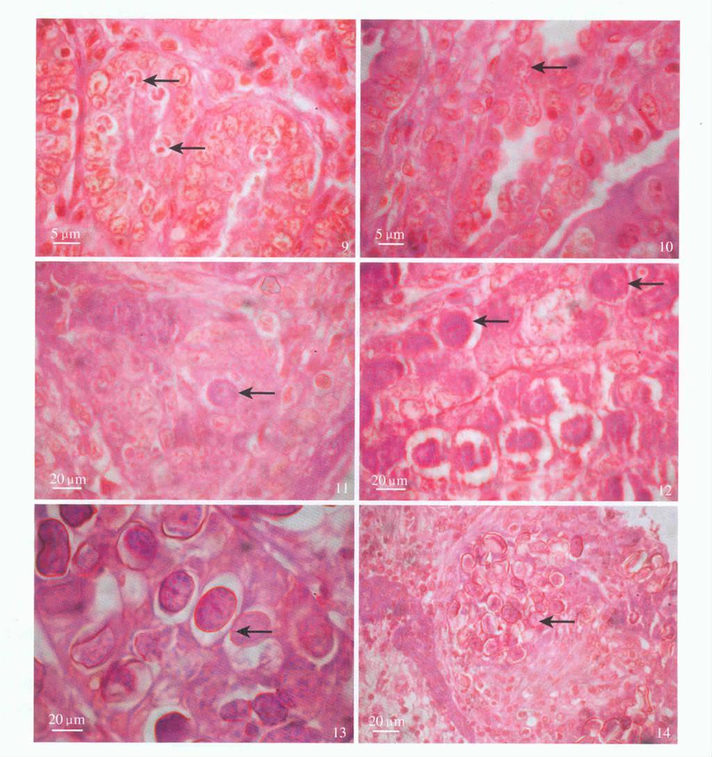 3 97 WANG Yan et al. Endogenous Development of Eimeria flavescens in Domestic Rabbit Ⅱ Plate Ⅱ 9. 4 1 000 10. 4 1 000 11. 1 000 12. 1 000 13. 1 000 14. 400 9.