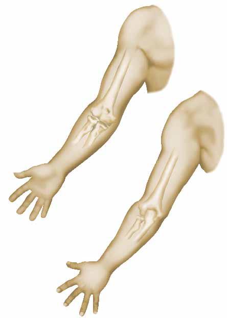 Ποιό μέρος του σώματος ; Ποιό μέρος του σώματος ; Ποιά η χρησιμότητα αυτού του μέρους του σώματος ; Ο αγκώνας επιτρέπει τις κινήσεις κάμψης και έκτασης του βραχίονα, καθώς και τις στροφικές κινήσεις